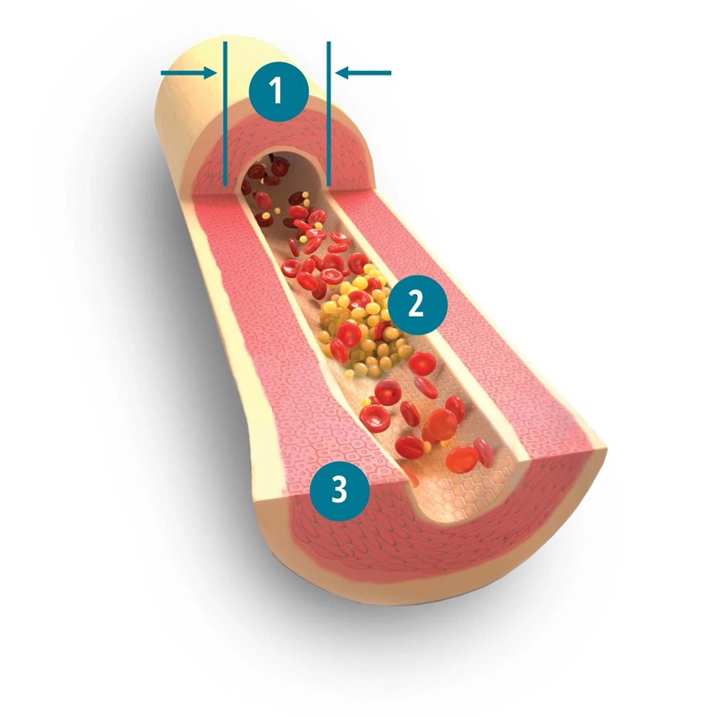 TYVASO (inhaled prostacyclin) mechanism of action