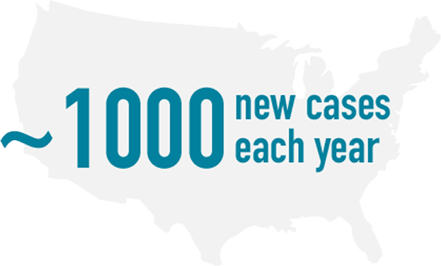 ~1000 new cases each year in the US